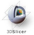 Item-Slicer 3D Slicer.jpeg