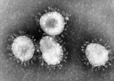 Coronavirus__comment_tout_savoir_sur_le_virus_Coronaviruses_004_lores.jpg