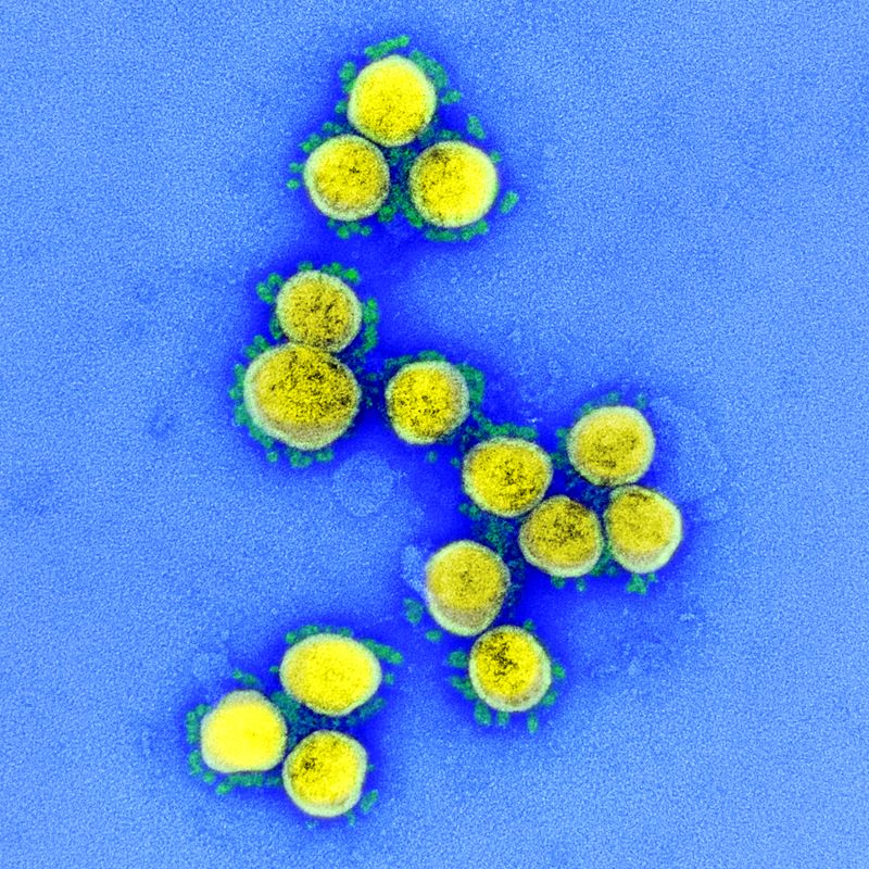 Coronavirus comment tout savoir sur le virus novel-coronavirus-sars-cov-2 49645120251 o.jpg