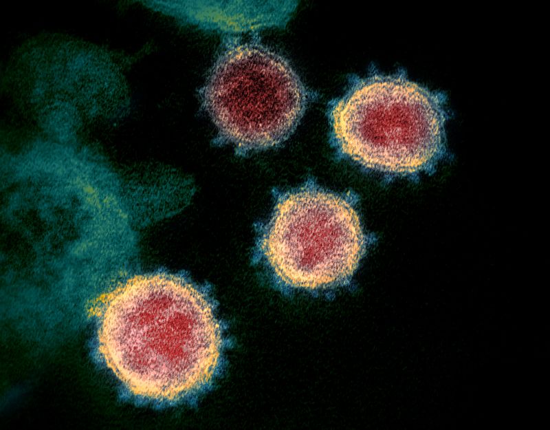 Coronavirus comment tout savoir sur le virus novel-coronavirus-sars-cov-2 49534865371 o.jpg